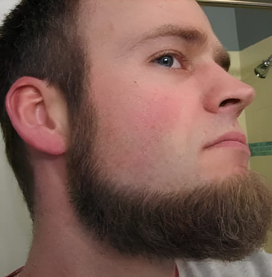 11 Stunning Beard Styles Without Mustache 8 Beard Without a Mustache instagram