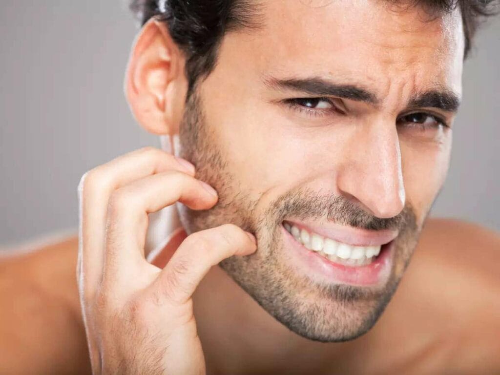How to Stop Beard Itch and Enjoy a Comfortable, Stylish Look 1 How to Stop Beard Itch and Enjoy a Comfortable, Stylish Look